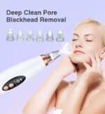 Blackhead Remover - Image 5