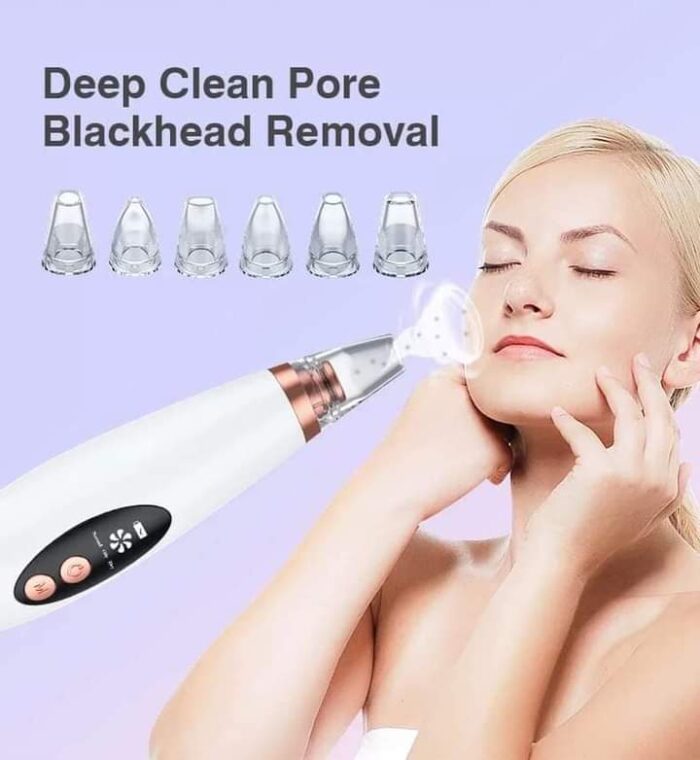 Blackhead Remover - Image 5