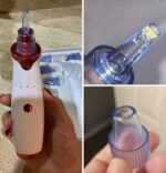 Blackhead Remover - Image 3